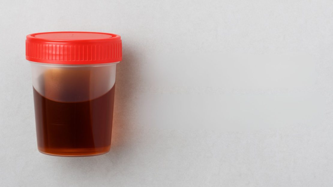 urine scure